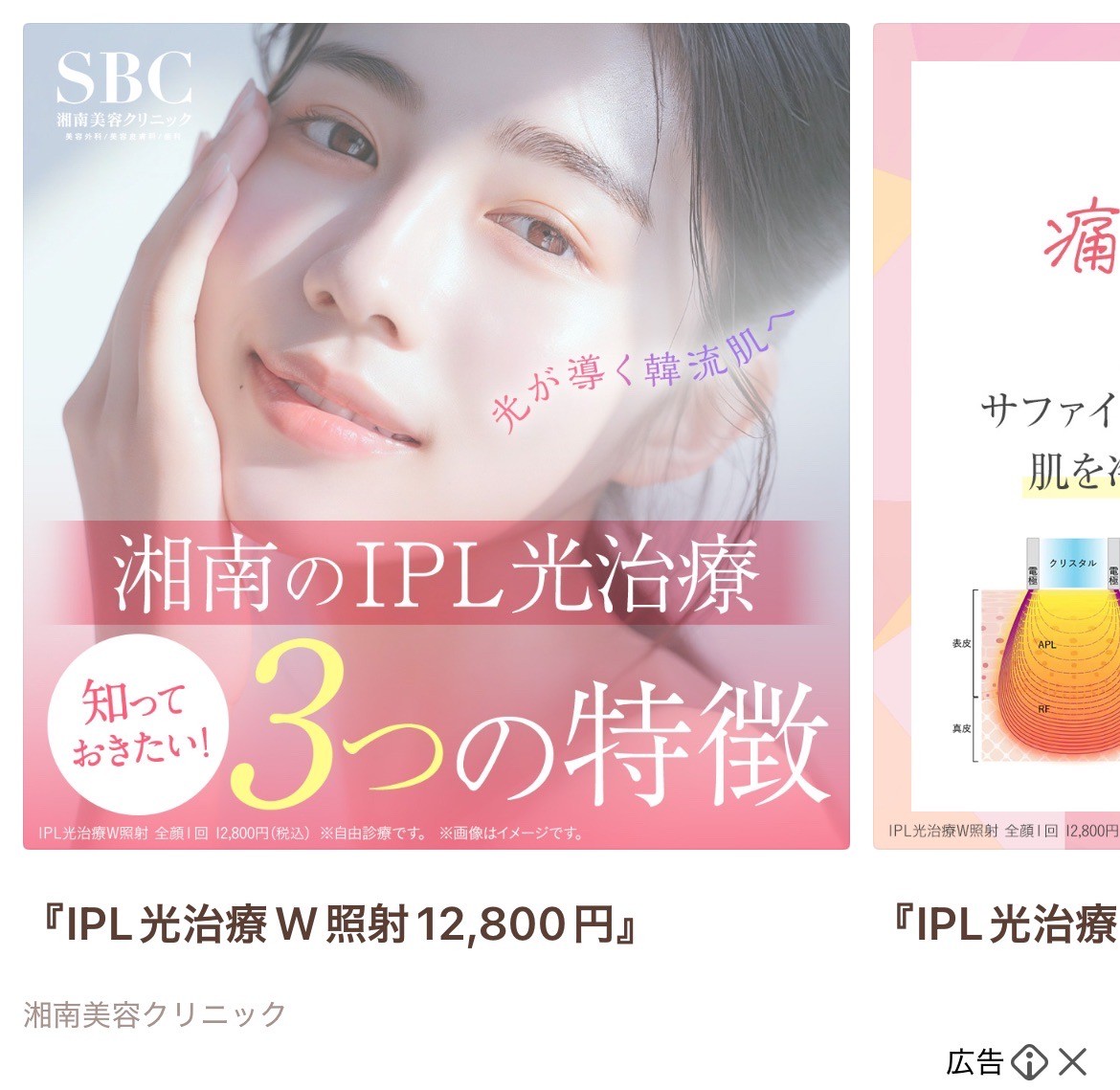 湘南美容クリニック　IPL光治療